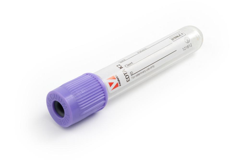 KRUUSE Blutentnahmeröhrchen EDTA K2, 5ml, 100 Stk KRUUSE Blutentnahmeröhrchen EDTA K2, 5ml, 100 Stk